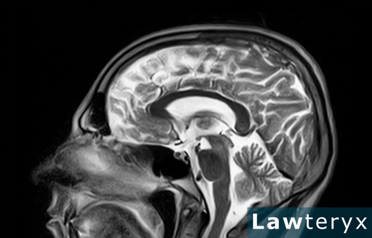 traumatic brain injury